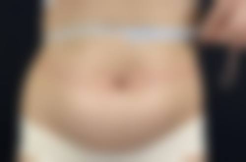 五、厦门爱思特张敏整形价格表