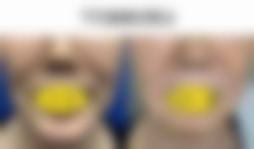 六、深圳建安医疗美容门诊部价格表