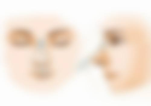 二、一只单眼皮一只双眼皮的后天原因