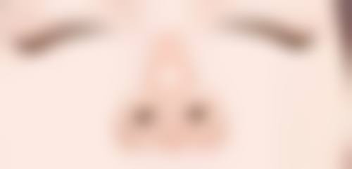 三、不同瘦脸项目的适合人群及注意事项