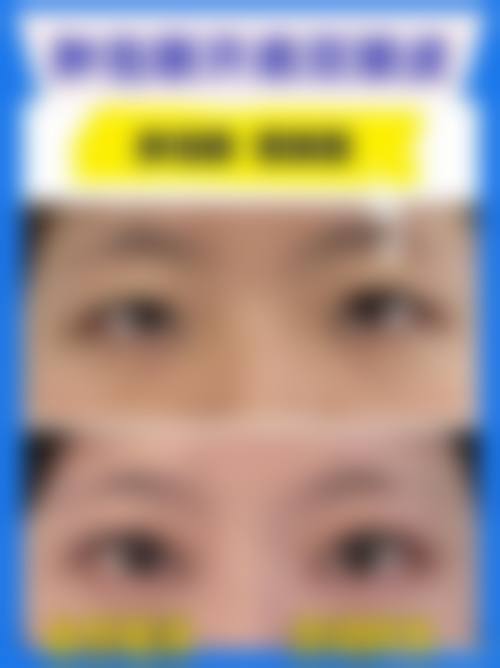 五、黄在宏怎么预约？