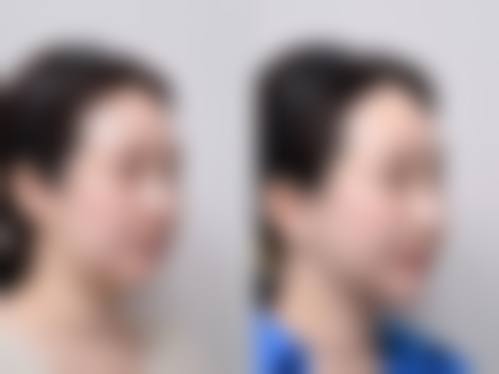 五、武汉叶子美容整形医院价格表