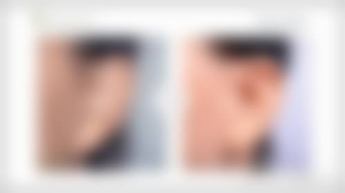 四、北京常好丽格整形特色项目