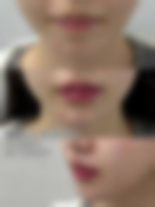 三、岳阳好熙医疗美容门诊部诊疗项目有哪些？