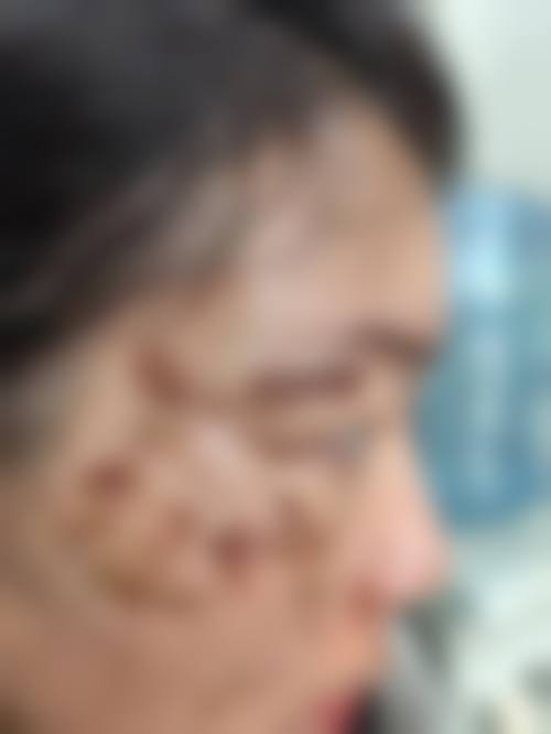 五、成都武侯博肤医疗美容门诊部价格表