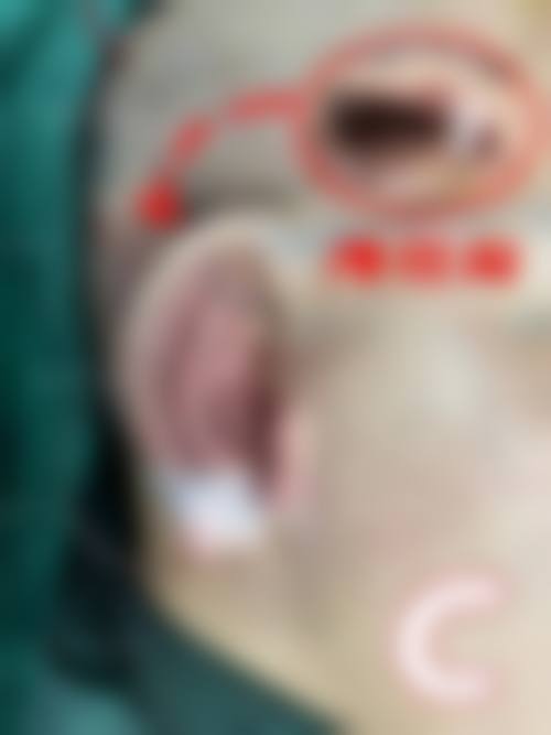 二、成都武侯博肤医疗美容门诊部怎么样？