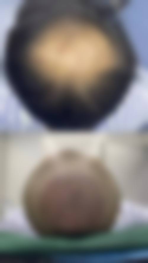 九、岳阳好熙医疗美容门诊部真实的患者评价