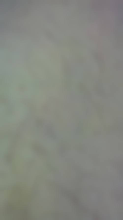 八、西安熙朵植发医疗美容门诊部预约方式