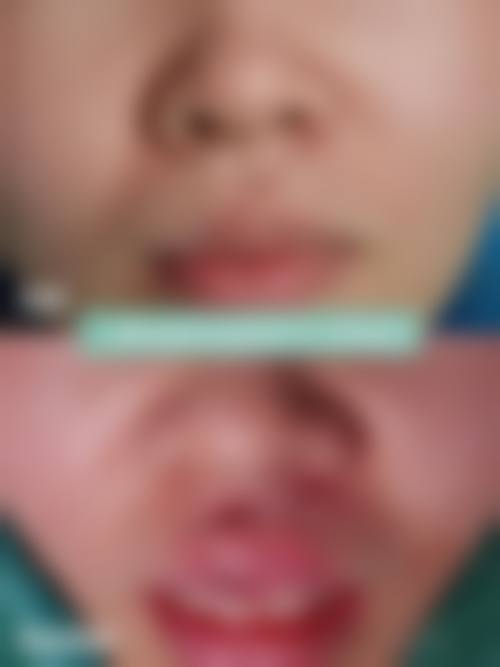 二、厦门安黛美整形医疗美容医院怎么样？