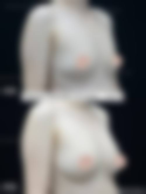 五、广州查尔曼医生医疗美容门诊部价格表