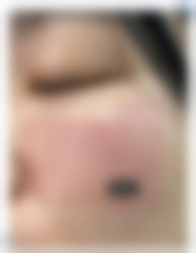 五、成都汉密尔顿美容整形医院价格表