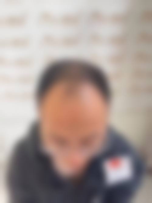 六、西安熙朵植发医疗美容门诊部价格表