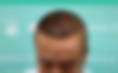 五、西安熙朵植发医疗美容门诊部医生介绍