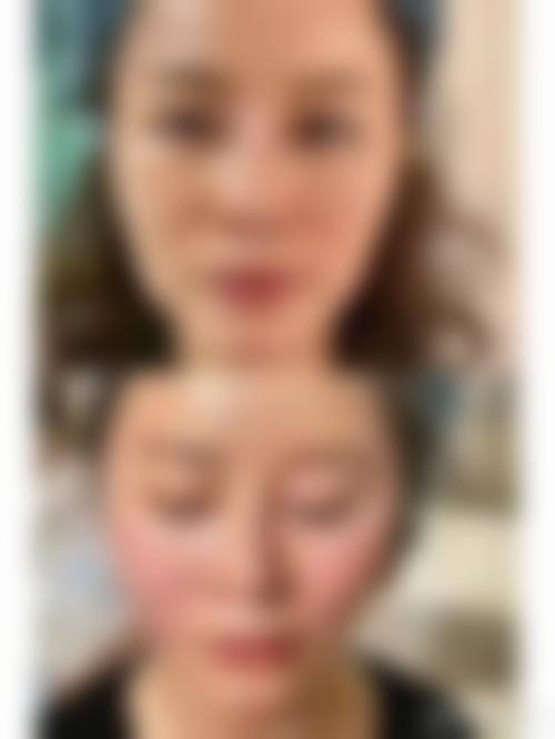 八、无锡玛丽亚整形美容医院真实的患者评价