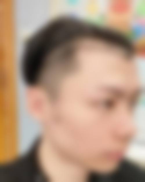 八、厦门安黛美整形医疗美容医院真实的患者评价