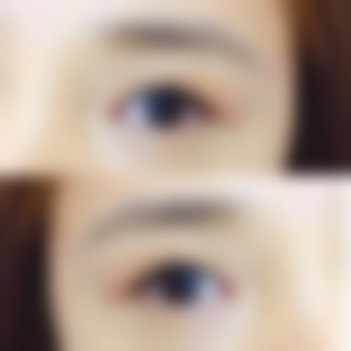 二、厦门爱思特张敏整形怎么样？