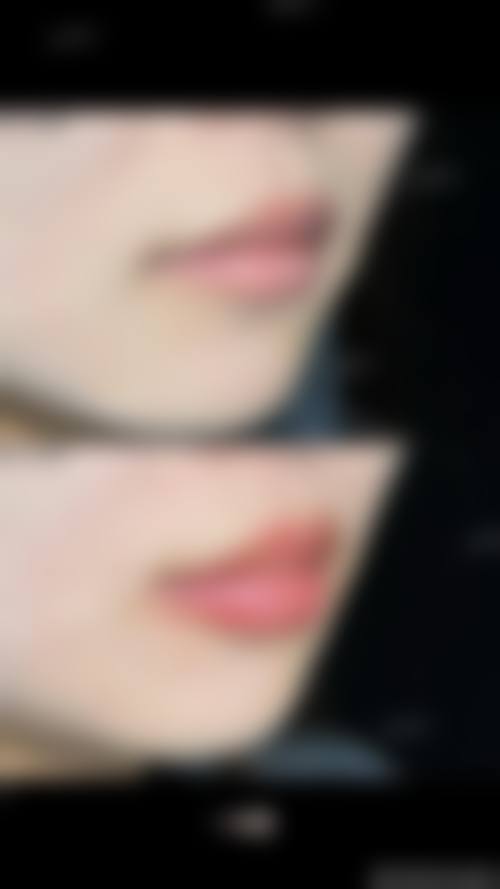 五、厦门安黛美整形医疗美容医院价格表