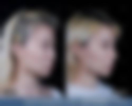 六、沈阳丽都整形医院价格表