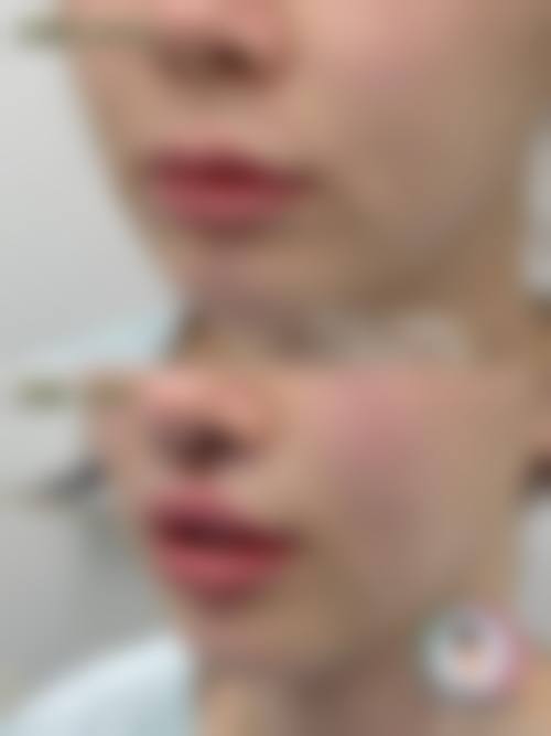 八、遇见美整形医院真实的患者评价