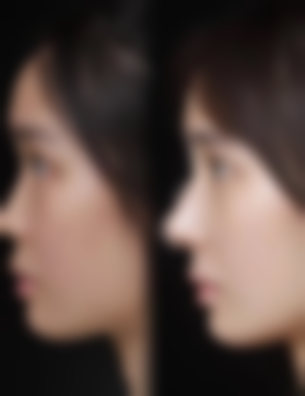 四、西安熙朵植发医疗美容门诊部特色项目