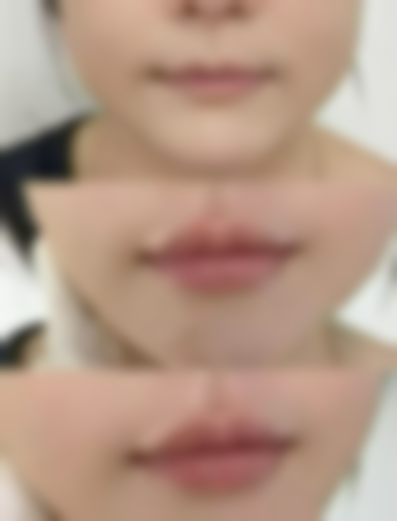 四、武汉叶子美容整形医院特色项目