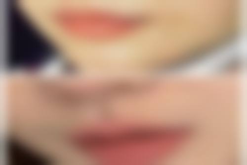 五、治疗疤痕疙瘩的注意事项