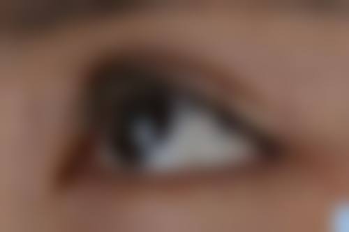 五、注射后异常情况及处理