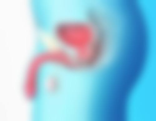 三、如何降低割双眼皮的副作用风险