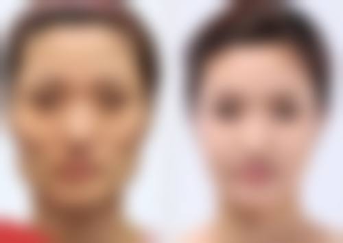 五、其他注意要点