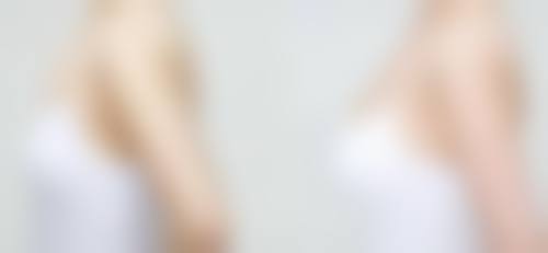 四、日照烁美医疗美容诊所特色项目