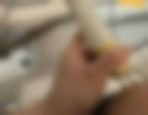 二、割完双眼皮多久能用艾草热敷