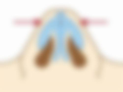 四、治疗方案选择参考