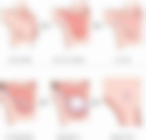 一、疤痕增生的核心管理原则