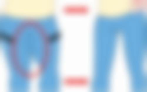 三、日常护理对改善割了双眼皮一个宽一个窄的重要性