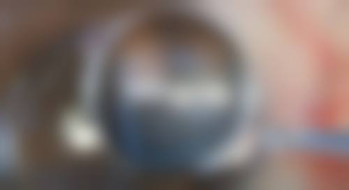 二、不同阶段副作用的高发情况及处理方式