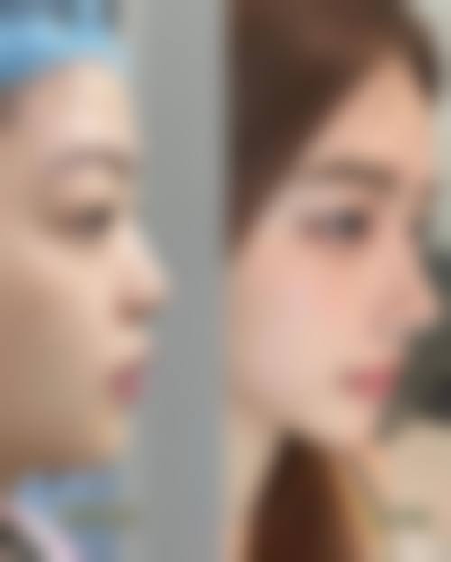 七、兰州仁和医院医疗美容科预约方式