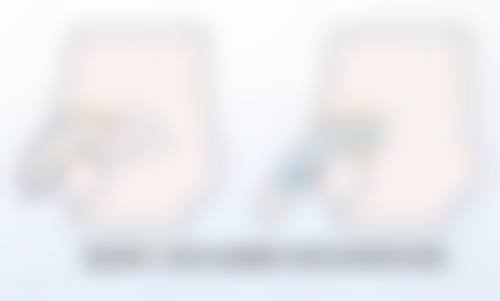 四、北京知音蕊丽医院特色项目