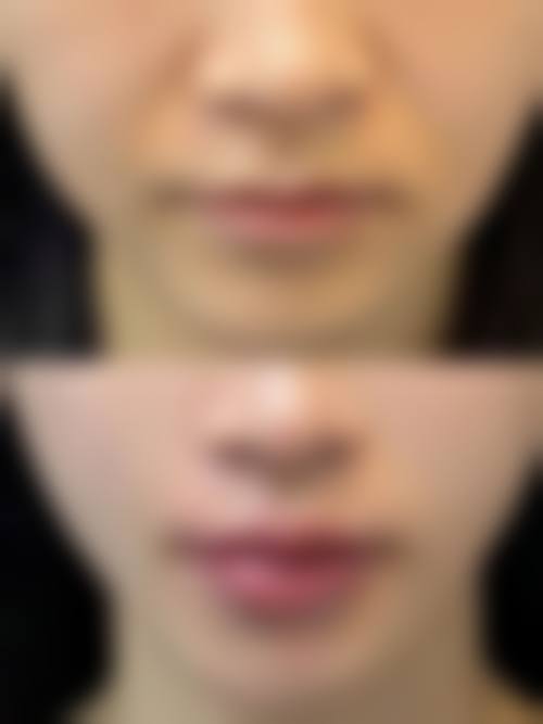 五、吉林纽妃斯医疗整形美容医院价格表