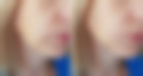 二、上海文峰整形医院怎么样？