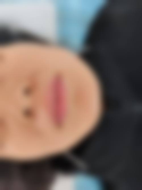 四、上海文峰整形医院特色项目