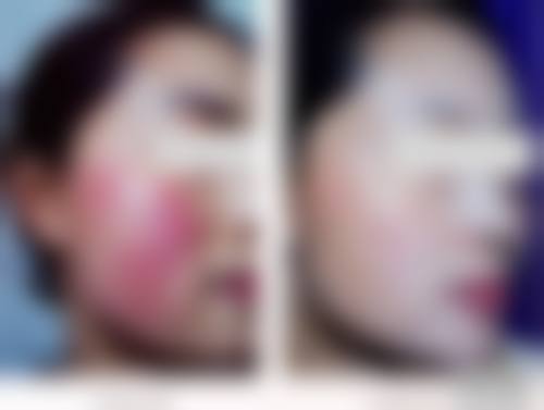 八、沧州市运西刘羚医疗整形美容诊所真实的患者评价