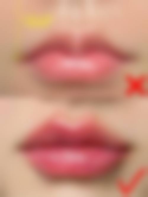 四、吉林纽妃斯医疗整形美容医院特色项目