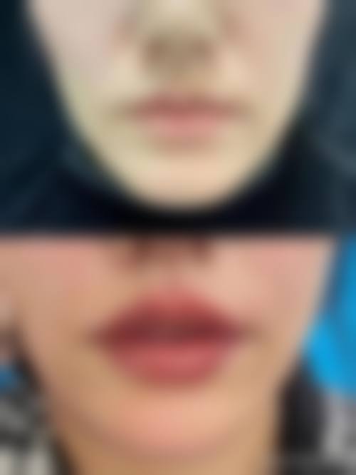 二、吉林纽妃斯医疗整形美容医院怎么样?