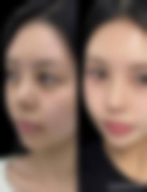 八、国内医 科 大学第一医院浑南国内外医院(整形外科)预约方式