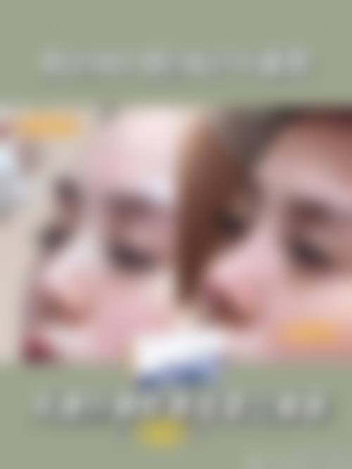 八、吉林纽妃斯医疗整形美容医院真实的患者评价