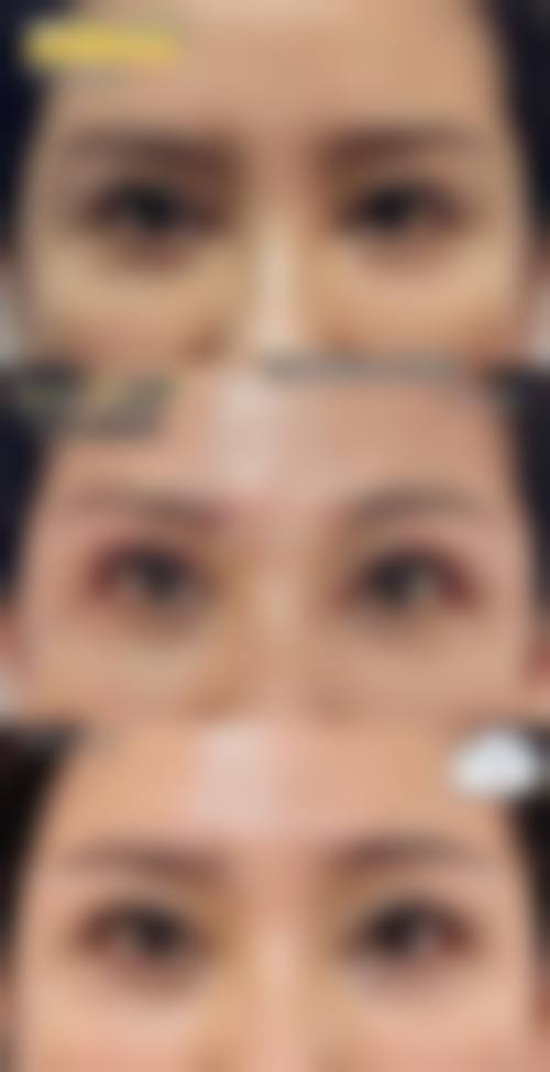 四、曲阜医联美医疗美容诊所特色项目