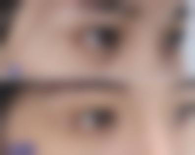 八、南宁雅致颜整形医院真实的患者评价