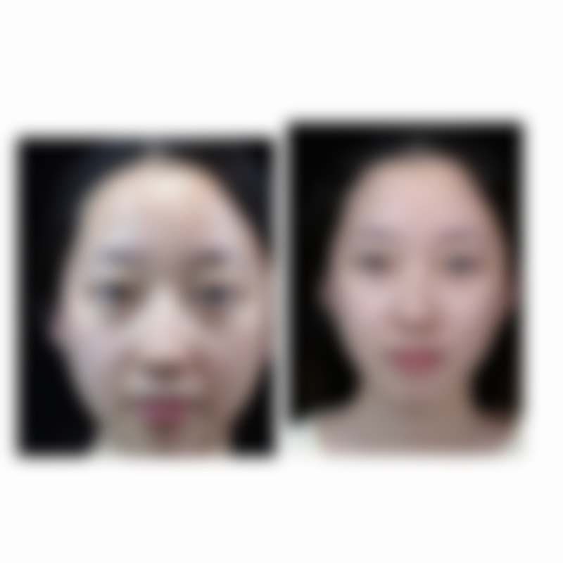 四、济南俪美医疗美容诊所特色项目