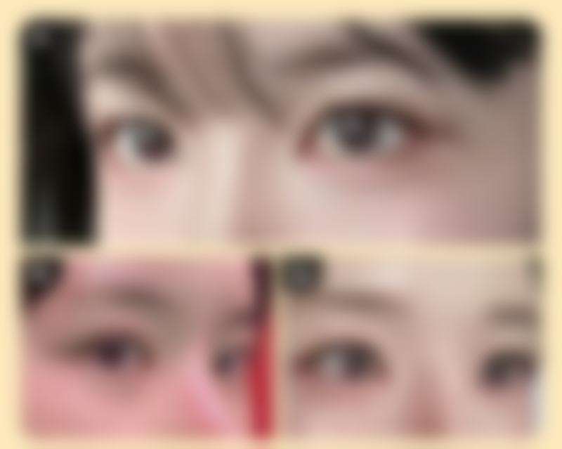 四、昌江萌亚医疗美容诊所特色项目