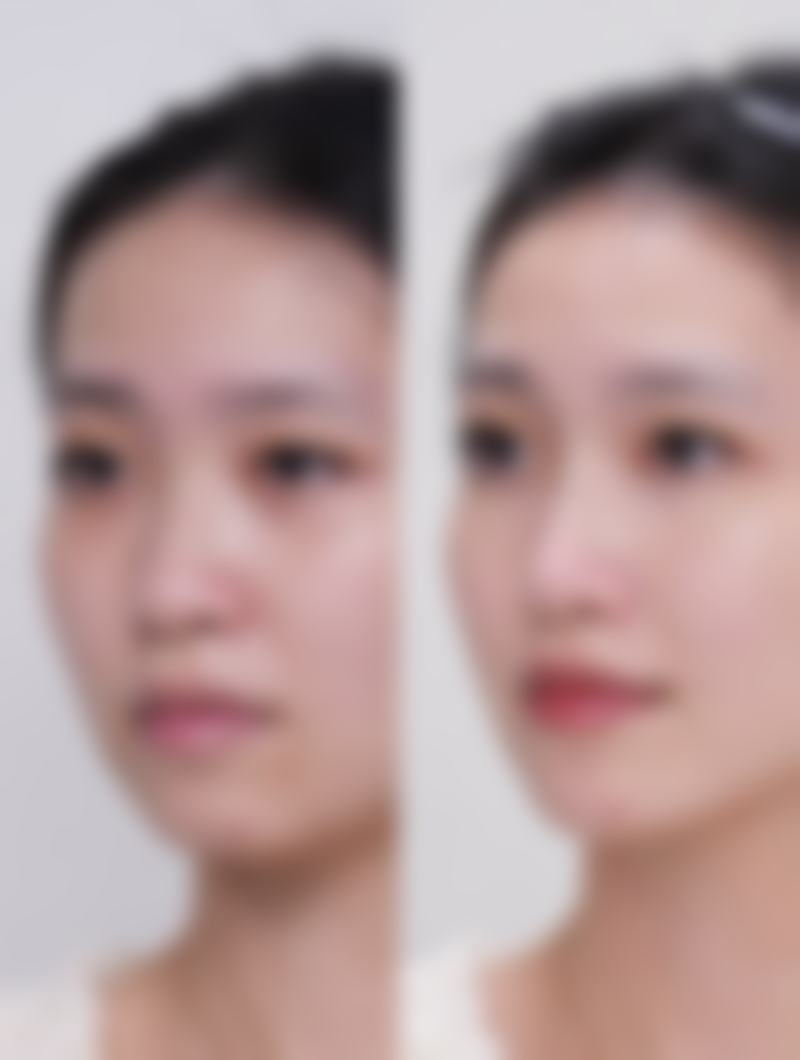 五、40岁女性眼袋特别大的其他辅助方法